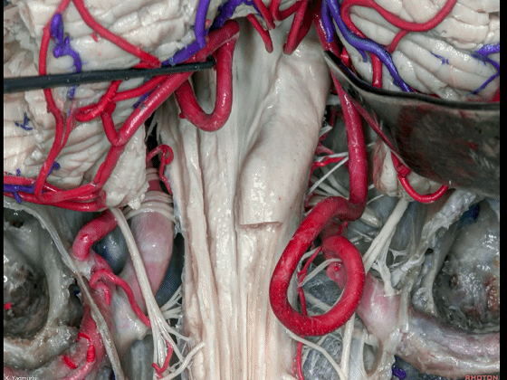 外展枕怎么使用脑干解剖及相关入路---Rhoton解剖视频学习笔记系列_https://www.jmylbn.com_新闻资讯_第141张