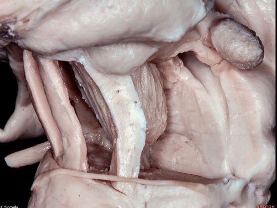 外展枕怎么使用脑干解剖及相关入路---Rhoton解剖视频学习笔记系列_https://www.jmylbn.com_新闻资讯_第83张