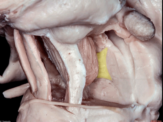 外展枕怎么使用脑干解剖及相关入路---Rhoton解剖视频学习笔记系列_https://www.jmylbn.com_新闻资讯_第86张