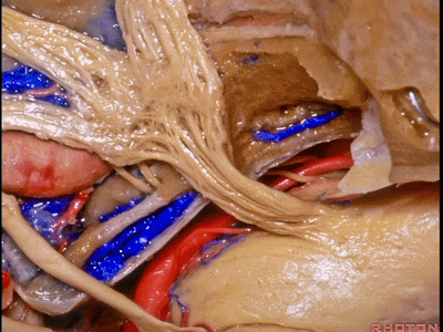 外展枕怎么使用脑干解剖及相关入路---Rhoton解剖视频学习笔记系列_https://www.jmylbn.com_新闻资讯_第197张