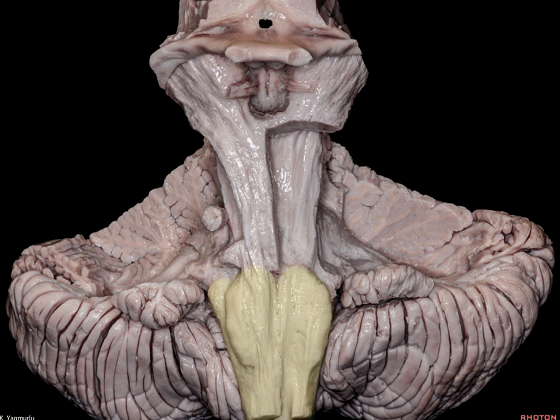 外展枕怎么使用脑干解剖及相关入路---Rhoton解剖视频学习笔记系列_https://www.jmylbn.com_新闻资讯_第14张