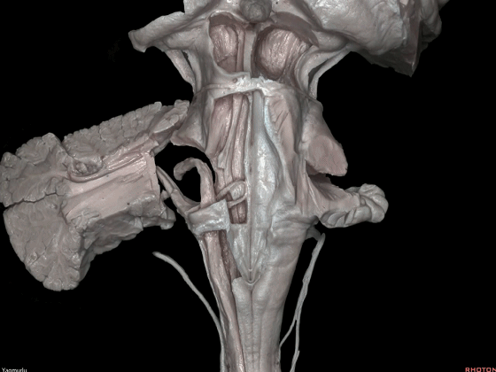 外展枕怎么使用脑干解剖及相关入路---Rhoton解剖视频学习笔记系列_https://www.jmylbn.com_新闻资讯_第23张