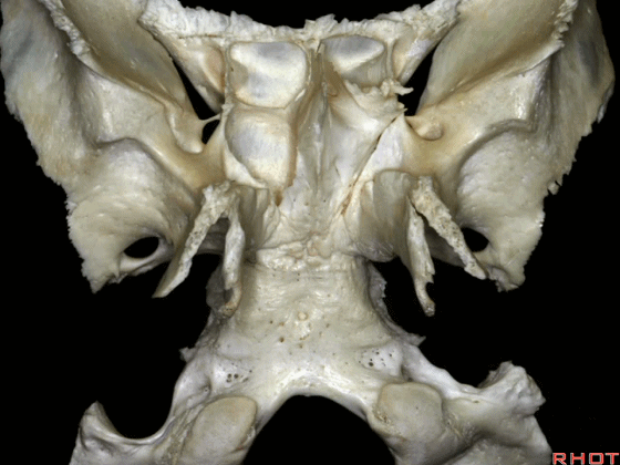 外展枕怎么使用脑干解剖及相关入路---Rhoton解剖视频学习笔记系列_https://www.jmylbn.com_新闻资讯_第331张