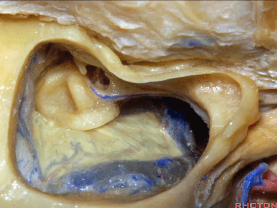 外展枕怎么使用脑干解剖及相关入路---Rhoton解剖视频学习笔记系列_https://www.jmylbn.com_新闻资讯_第284张