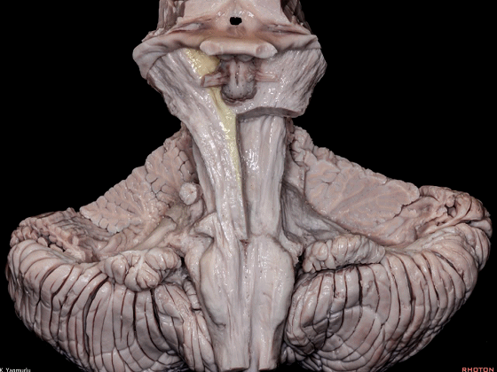 外展枕怎么使用脑干解剖及相关入路---Rhoton解剖视频学习笔记系列_https://www.jmylbn.com_新闻资讯_第13张