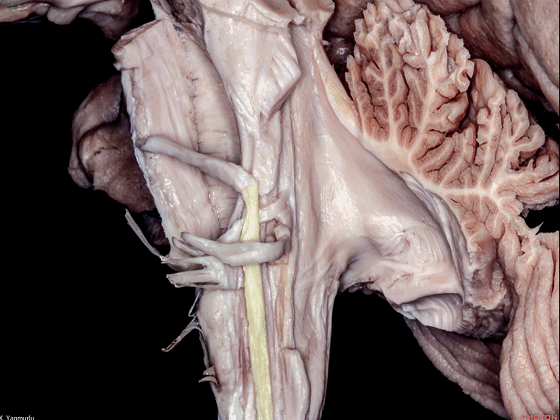 外展枕怎么使用脑干解剖及相关入路---Rhoton解剖视频学习笔记系列_https://www.jmylbn.com_新闻资讯_第102张