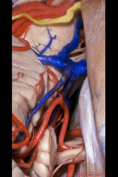 外展枕怎么使用脑干解剖及相关入路---Rhoton解剖视频学习笔记系列_https://www.jmylbn.com_新闻资讯_第271张