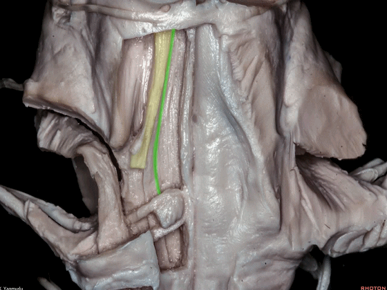 外展枕怎么使用脑干解剖及相关入路---Rhoton解剖视频学习笔记系列_https://www.jmylbn.com_新闻资讯_第126张