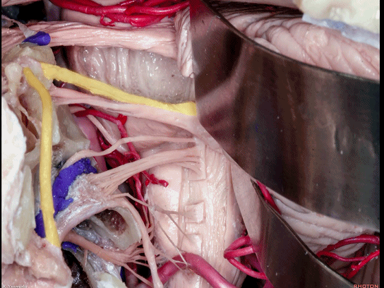 外展枕怎么使用脑干解剖及相关入路---Rhoton解剖视频学习笔记系列_https://www.jmylbn.com_新闻资讯_第94张