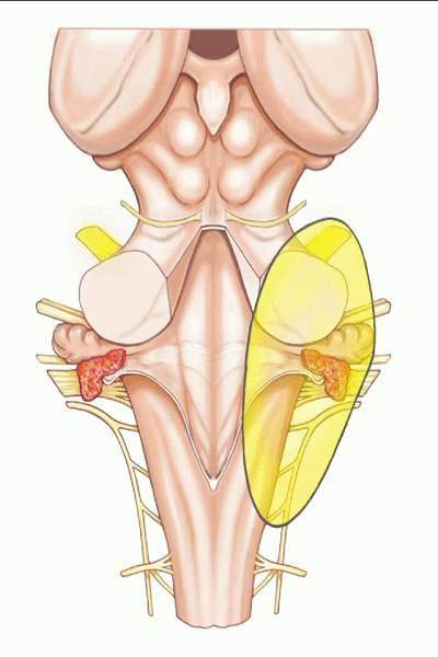 外展枕怎么使用脑干解剖及相关入路---Rhoton解剖视频学习笔记系列_https://www.jmylbn.com_新闻资讯_第267张