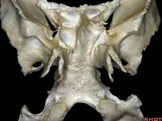 外展枕怎么使用脑干解剖及相关入路---Rhoton解剖视频学习笔记系列_https://www.jmylbn.com_新闻资讯_第332张