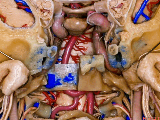 外展枕怎么使用脑干解剖及相关入路---Rhoton解剖视频学习笔记系列_https://www.jmylbn.com_新闻资讯_第352张