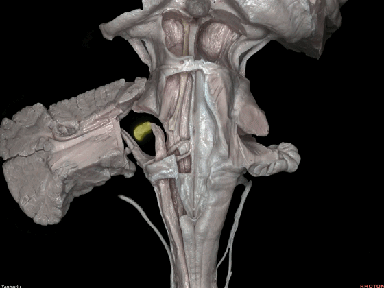 外展枕怎么使用脑干解剖及相关入路---Rhoton解剖视频学习笔记系列_https://www.jmylbn.com_新闻资讯_第25张
