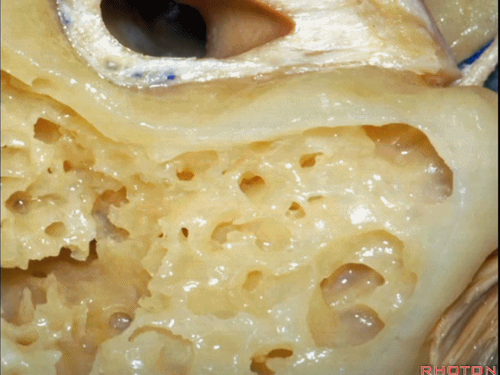 外展枕怎么使用脑干解剖及相关入路---Rhoton解剖视频学习笔记系列_https://www.jmylbn.com_新闻资讯_第279张