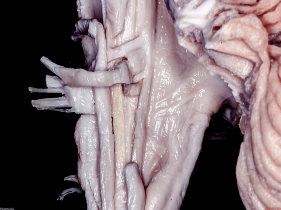 外展枕怎么使用脑干解剖及相关入路---Rhoton解剖视频学习笔记系列_https://www.jmylbn.com_新闻资讯_第138张