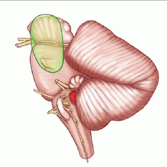 外展枕怎么使用脑干解剖及相关入路---Rhoton解剖视频学习笔记系列_https://www.jmylbn.com_新闻资讯_第181张