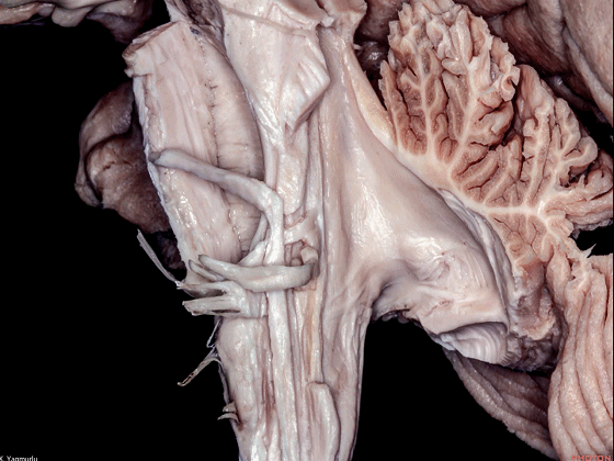 外展枕怎么使用脑干解剖及相关入路---Rhoton解剖视频学习笔记系列_https://www.jmylbn.com_新闻资讯_第99张