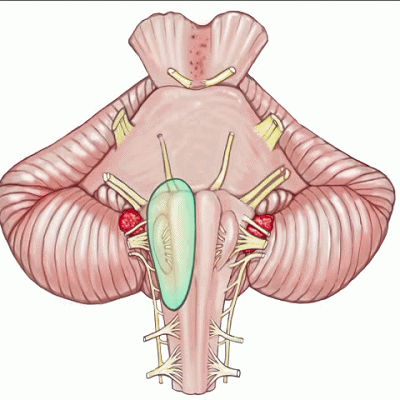 外展枕怎么使用脑干解剖及相关入路---Rhoton解剖视频学习笔记系列_https://www.jmylbn.com_新闻资讯_第162张