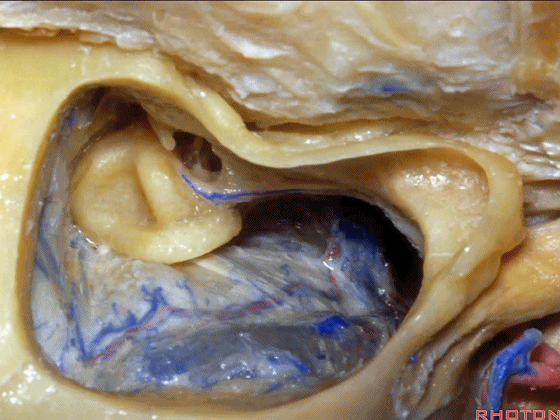 外展枕怎么使用脑干解剖及相关入路---Rhoton解剖视频学习笔记系列_https://www.jmylbn.com_新闻资讯_第281张