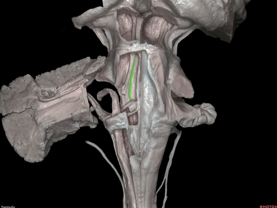 外展枕怎么使用脑干解剖及相关入路---Rhoton解剖视频学习笔记系列_https://www.jmylbn.com_新闻资讯_第30张