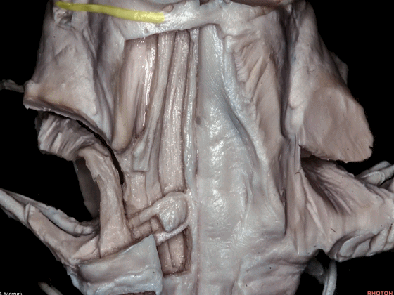 外展枕怎么使用脑干解剖及相关入路---Rhoton解剖视频学习笔记系列_https://www.jmylbn.com_新闻资讯_第122张