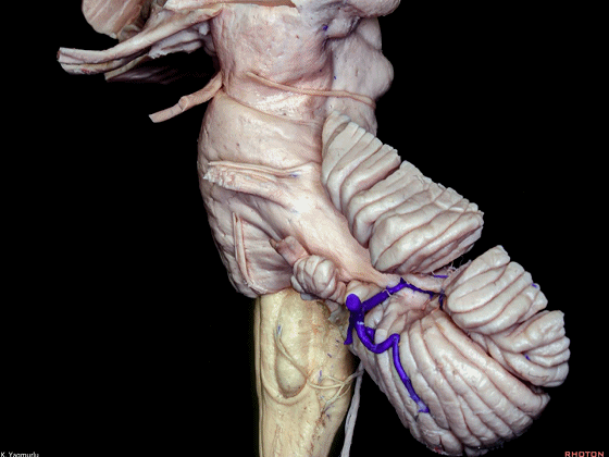 外展枕怎么使用脑干解剖及相关入路---Rhoton解剖视频学习笔记系列_https://www.jmylbn.com_新闻资讯_第37张