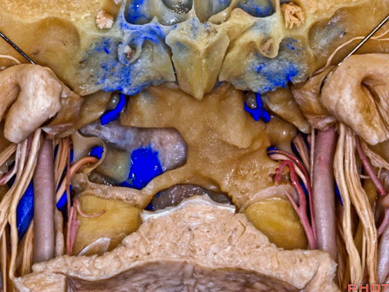 外展枕怎么使用脑干解剖及相关入路---Rhoton解剖视频学习笔记系列_https://www.jmylbn.com_新闻资讯_第334张