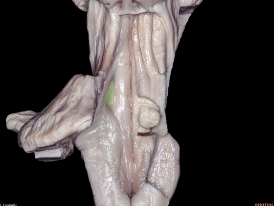 外展枕怎么使用脑干解剖及相关入路---Rhoton解剖视频学习笔记系列_https://www.jmylbn.com_新闻资讯_第118张