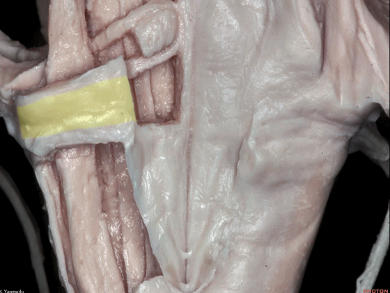 外展枕怎么使用脑干解剖及相关入路---Rhoton解剖视频学习笔记系列_https://www.jmylbn.com_新闻资讯_第130张