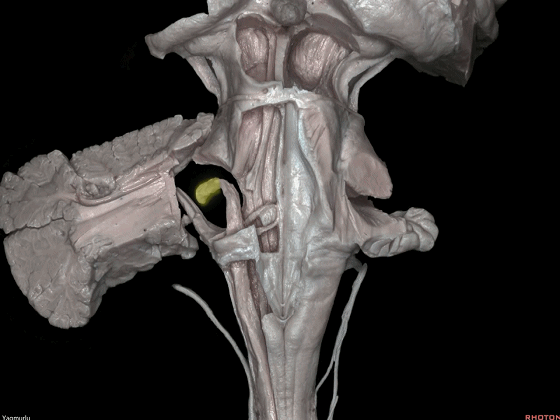 外展枕怎么使用脑干解剖及相关入路---Rhoton解剖视频学习笔记系列_https://www.jmylbn.com_新闻资讯_第24张