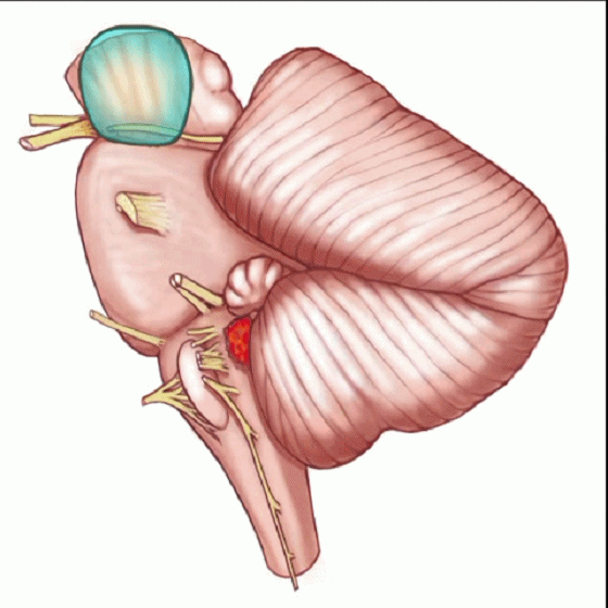 外展枕怎么使用脑干解剖及相关入路---Rhoton解剖视频学习笔记系列_https://www.jmylbn.com_新闻资讯_第146张