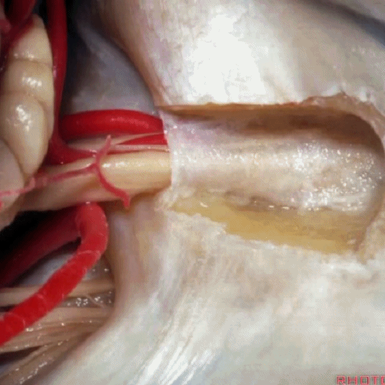 外展枕怎么使用脑干解剖及相关入路---Rhoton解剖视频学习笔记系列_https://www.jmylbn.com_新闻资讯_第273张