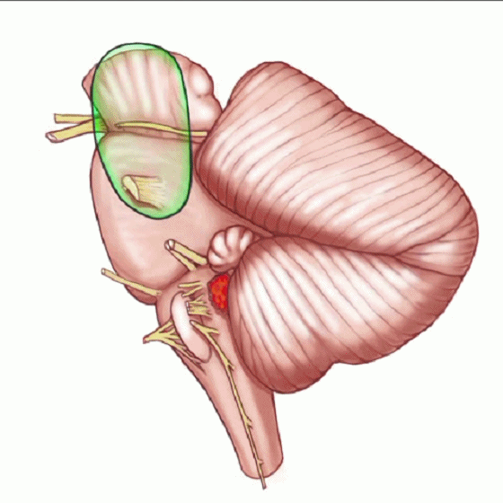 外展枕怎么使用脑干解剖及相关入路---Rhoton解剖视频学习笔记系列_https://www.jmylbn.com_新闻资讯_第148张