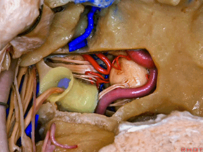 外展枕怎么使用脑干解剖及相关入路---Rhoton解剖视频学习笔记系列_https://www.jmylbn.com_新闻资讯_第336张