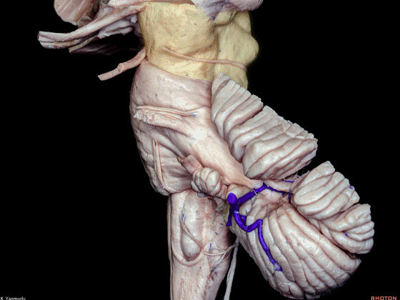 外展枕怎么使用脑干解剖及相关入路---Rhoton解剖视频学习笔记系列_https://www.jmylbn.com_新闻资讯_第32张