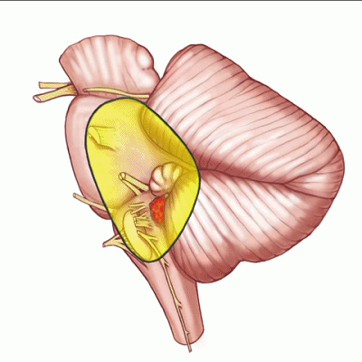 外展枕怎么使用脑干解剖及相关入路---Rhoton解剖视频学习笔记系列_https://www.jmylbn.com_新闻资讯_第155张