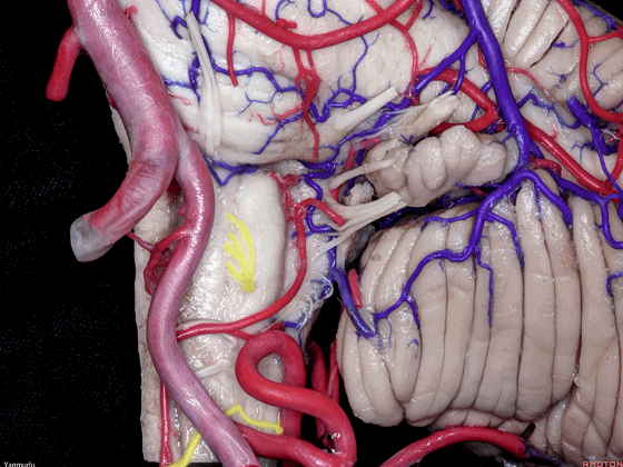 外展枕怎么使用脑干解剖及相关入路---Rhoton解剖视频学习笔记系列_https://www.jmylbn.com_新闻资讯_第136张