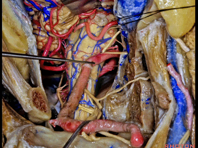 外展枕怎么使用脑干解剖及相关入路---Rhoton解剖视频学习笔记系列_https://www.jmylbn.com_新闻资讯_第324张