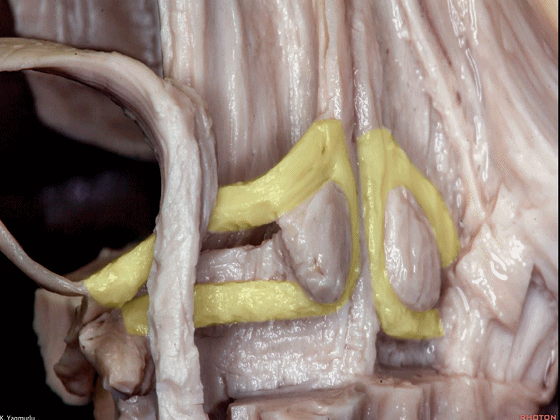 外展枕怎么使用脑干解剖及相关入路---Rhoton解剖视频学习笔记系列_https://www.jmylbn.com_新闻资讯_第111张