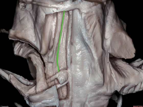 外展枕怎么使用脑干解剖及相关入路---Rhoton解剖视频学习笔记系列_https://www.jmylbn.com_新闻资讯_第125张