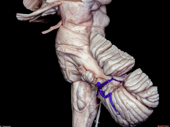 外展枕怎么使用脑干解剖及相关入路---Rhoton解剖视频学习笔记系列_https://www.jmylbn.com_新闻资讯_第39张