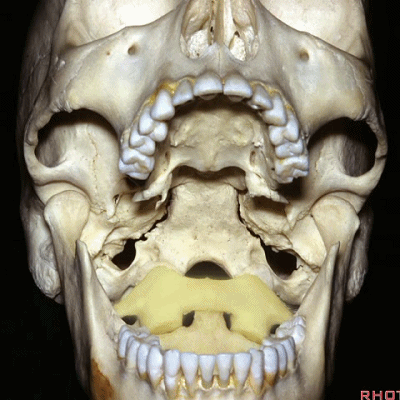 外展枕怎么使用脑干解剖及相关入路---Rhoton解剖视频学习笔记系列_https://www.jmylbn.com_新闻资讯_第308张