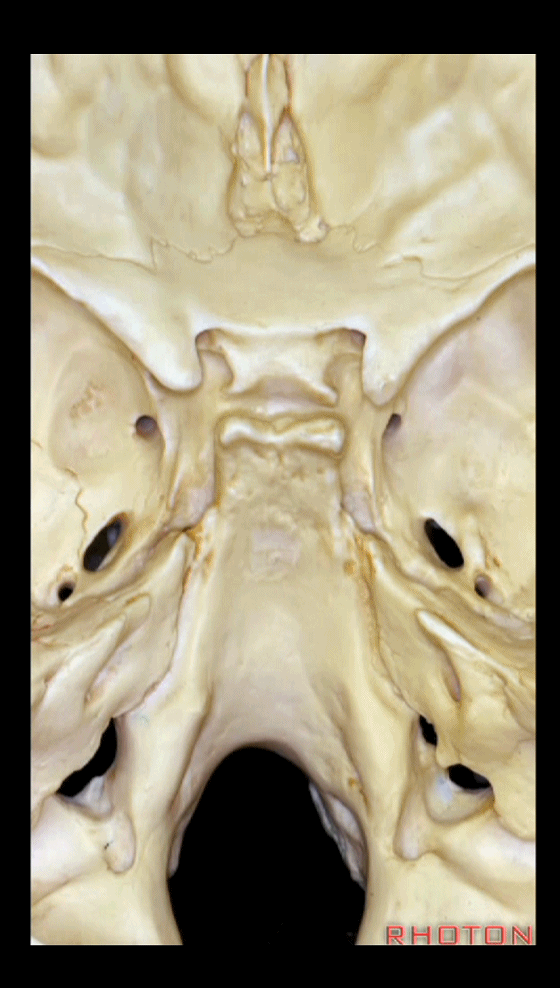 外展枕怎么使用脑干解剖及相关入路---Rhoton解剖视频学习笔记系列_https://www.jmylbn.com_新闻资讯_第328张