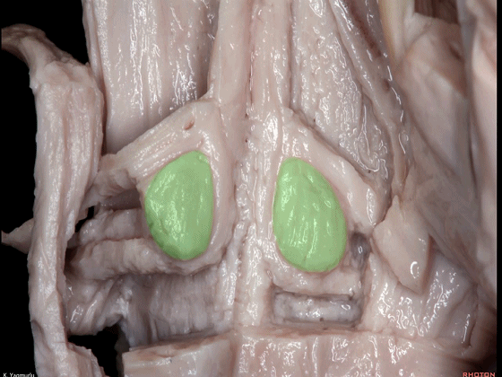 外展枕怎么使用脑干解剖及相关入路---Rhoton解剖视频学习笔记系列_https://www.jmylbn.com_新闻资讯_第110张