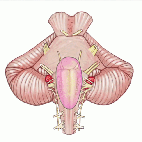 外展枕怎么使用脑干解剖及相关入路---Rhoton解剖视频学习笔记系列_https://www.jmylbn.com_新闻资讯_第163张