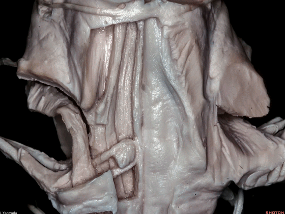 外展枕怎么使用脑干解剖及相关入路---Rhoton解剖视频学习笔记系列_https://www.jmylbn.com_新闻资讯_第121张