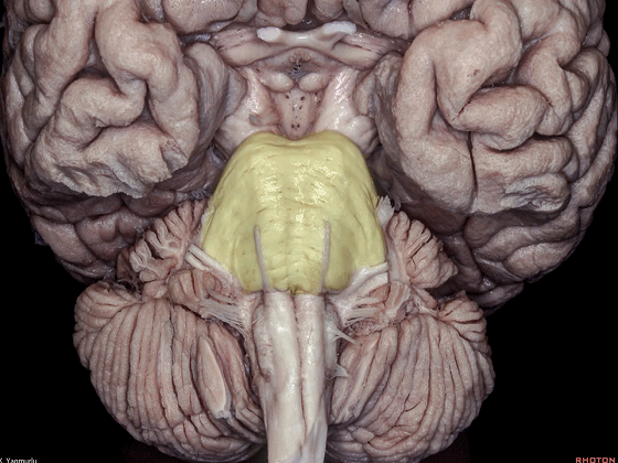 外展枕怎么使用脑干解剖及相关入路---Rhoton解剖视频学习笔记系列_https://www.jmylbn.com_新闻资讯_第5张