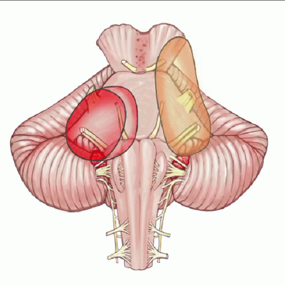 外展枕怎么使用脑干解剖及相关入路---Rhoton解剖视频学习笔记系列_https://www.jmylbn.com_新闻资讯_第292张
