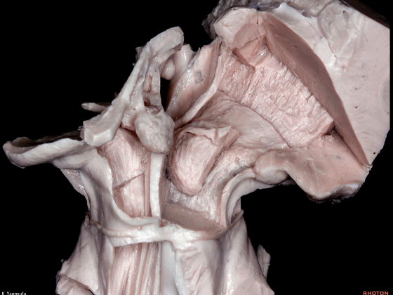 外展枕怎么使用脑干解剖及相关入路---Rhoton解剖视频学习笔记系列_https://www.jmylbn.com_新闻资讯_第88张