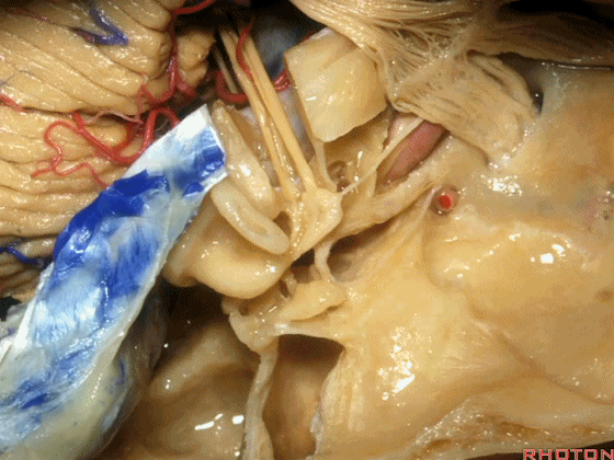 外展枕怎么使用脑干解剖及相关入路---Rhoton解剖视频学习笔记系列_https://www.jmylbn.com_新闻资讯_第183张